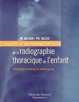 Broché Guide d'interprétation de la radiographie thoracique de l'enfant : séméiologie normale et pathologique de VALOIS Philippe HASSAN Max