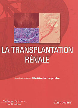 Broché La transplantation rénale de LEGENDRE Christophe