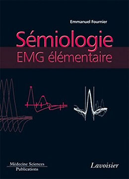 Broschiert Electromyographie. Vol. 2. Sémiologie EMG élémentaire : technique par technique von FOURNIER Cecile FOURNIER Emmanuel