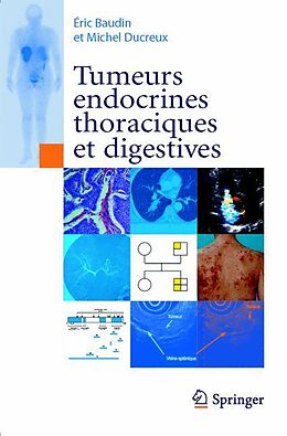 E-Book (pdf) Tumeurs endocrines thoraciques et digestives von Éric Baudin, Michel Ducreux