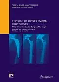 E-Book (pdf) Revision of loose femoral prostheses with a stem system based on the "press-fit" principle von Pierre Le Béguec, Hans-Peter Sieber