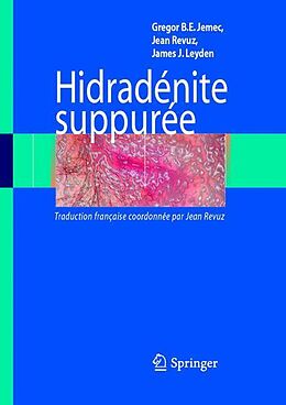 eBook (pdf) Hidradénite suppurée de Gregor Jemec, Jean Revuz, James J. Leyden