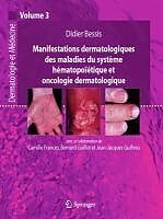 eBook (pdf) Manifestations dermatologiques des maladies du système hématopoïétique et oncologie dermatologique de Didier Bessis, Camille Francès, Bernard Guillot