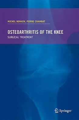 E-Book (pdf) Osteoarthritis of the knee von Michel Bonnin, Pierre Chambat