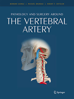 eBook (pdf) Pathology and surgery around the vertebral artery de Bernard George, Michaël Bruneau, Robert F. Spetzler