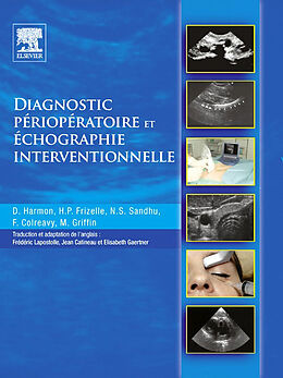 eBook (pdf) Diagnostic perioperatoire et echographie interventionnelle de Dominic Harmon