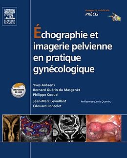 E-Book (pdf) Echographie et imagerie pelvienne en pratique gynecologique von Yves Ardaens
