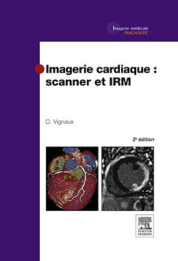 eBook (pdf) Imagerie cardiaque : scanner et IRM de Olivier Vignaux