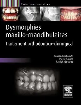 E-Book (pdf) Dysmorphies maxillo-mandibulaires von Pierre Canal