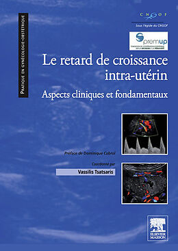 eBook (pdf) Le retard de croissance intra-uterin de Vassilis Tsatsaris