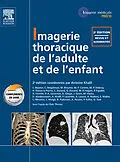 E-Book (pdf) Imagerie thoracique de l'enfant et de l'adulte von Antoine Khalil