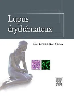 E-Book (pdf) Lupus erythemateux von Dan Lipsker
