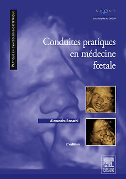 eBook (pdf) Conduites pratiques en medecine foetale de Alexandra Benachi