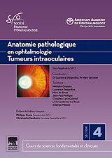 eBook (pdf) Anatomie pathologique en ophtalmologie. Tumeurs intraoculaires de Marc D. de Smet