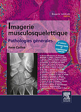 eBook (epub) Imagerie musculosquelettique : pathologies generales de Anne Cotten