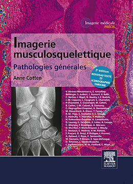 eBook (epub) Imagerie musculosquelettique : pathologies generales de Anne Cotten