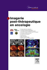 eBook (pdf) Imagerie post-therapeutique en oncologie de Societe Francaise De Radiologie