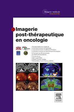 E-Book (epub) Imagerie post-therapeutique en oncologie von Societe Francaise De Radiologie