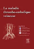E-Book (epub) La maladie thrombo-embolique veineuse von Philippe Lacroix