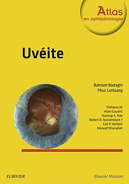 E-Book (epub) Uveite von Bahram Bodaghi