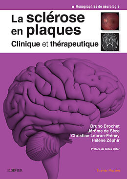 eBook (epub) La sclerose en plaques - Clinique et therapeutique de Bruno Brochet