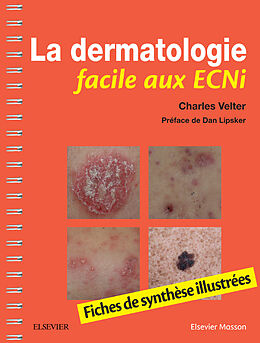 eBook (pdf) La dermatologie facile aux ECNi de Charles Velter