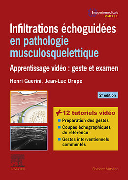 E-Book (epub) Infiltrations échoguidées en pathologie musculosquelettique von Jean-Luc Drapé, Henri Guerini