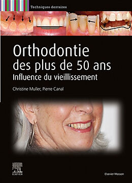 Broché Orthodontie des plus de 50 ans de Christine; Canal, Pierre Muller