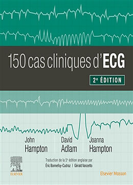 Broché 150 cas cliniques d'ECG de John; Adlam, David; Hampton, Joanna Hampton