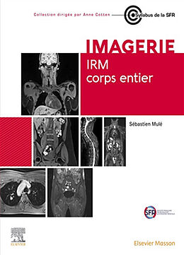 Broché IRM corps entier de Sébastien Mulé