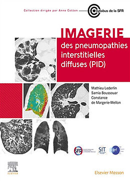 Broché Imagerie des pneumopathies interstitielles diffuses (PID) de M.; Boussouar, S.; Margerie-Mellon, C.de Lederlin