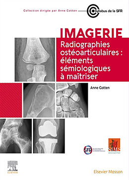 Broché Radiographies ostéoarticulaires : éléments sémiologiques à maîtriser de Anne Cotten