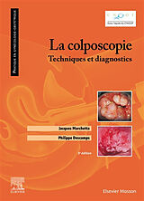 Broché La colposcopie : techniques et diagnostics de Descamps-p+marchetta