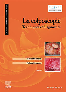 Broché La colposcopie : techniques et diagnostics de Descamps-p+marchetta