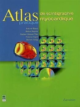 Broché Atlas pratique de scintigraphie myocardique de MAYORAZ Matias, VAZQUEZ PAEZ Gusta BLASCO Antoine