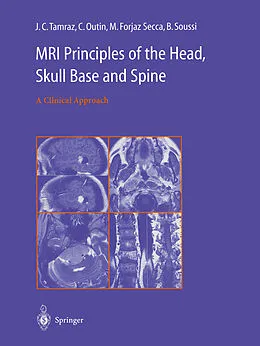 E-Book (pdf) MRI Principles of the Head, Skull Base and Spine von J. C. Tamraz, C. Outin, M. Forjaz Secca