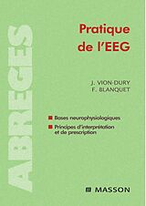 E-Book (pdf) Pratique de l'EEG von Jean Vion-Dury