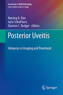 Fester Einband Posterior Uveitis von 