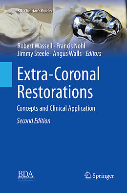 Couverture cartonnée Extra-Coronal Restorations de 