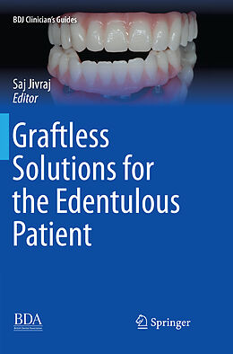 Couverture cartonnée Graftless Solutions for the Edentulous Patient de 