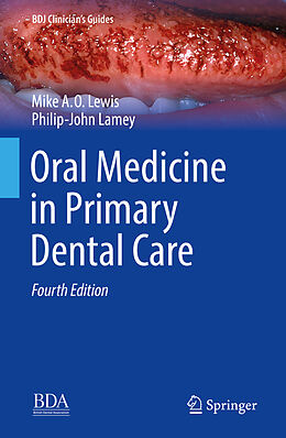 Livre Relié Oral Medicine in Primary Dental Care de Michael A. O. Lewis, Philip-John Lamey