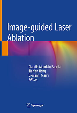 Livre Relié Image-guided Laser Ablation de 