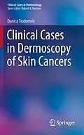 E-Book (pdf) Clinical Cases in Dermoscopy of Skin Cancers von Danica Tiodorovic