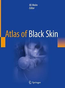 E-Book (pdf) Atlas of Black Skin von 