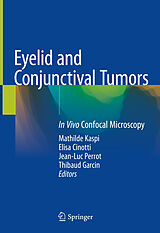 eBook (pdf) Eyelid and Conjunctival Tumors de 
