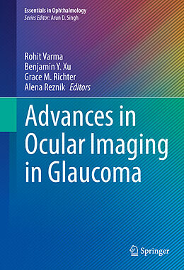 Fester Einband Advances in Ocular Imaging in Glaucoma von 