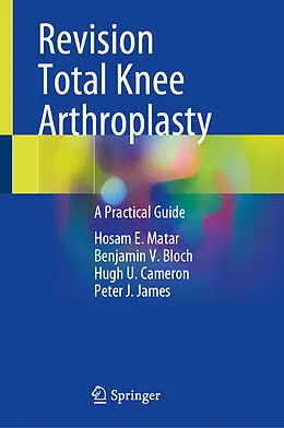 E-Book (pdf) Revision Total Knee Arthroplasty von Hosam E. Matar, Benjamin V. Bloch, Hugh U. Cameron