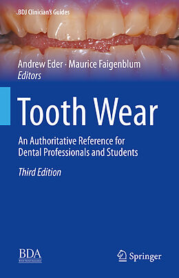 Livre Relié Tooth Wear de 