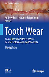 eBook (pdf) Tooth Wear de 