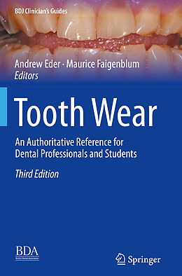 Couverture cartonnée Tooth Wear de 